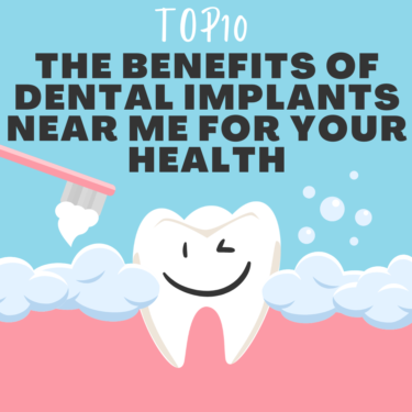 TOP10 The Benefits of Dental Implants Near Me for your Health